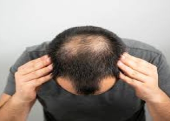 Saç tökülməsinin səbəbləri