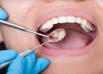 Diş sağlamlığı üçün ən təhlükəli vərdişlər - Heç vaxt bunları etməyin