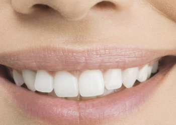 Dişləri qorumağın ən sadə yolu: düzgün qidalanma niyə bu qədər vacibdir?