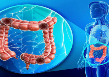 Bağırsaq sağlamlığı yaşlanmaya necə təsir edir?