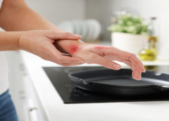 Qaynar yağdan yanıq — ilk dəqiqələrdə nə edək?