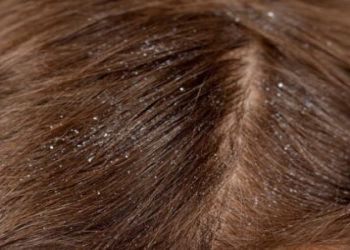 Saçların bərpası üçün ən effektiv prosedurlar