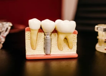 Orqanizmdə tamamilə əriyən metal implantlar yaradıldı