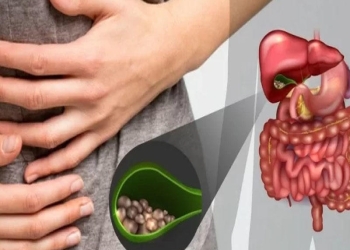 Öd kisəsi niyə əyilir? - Səbəbləri