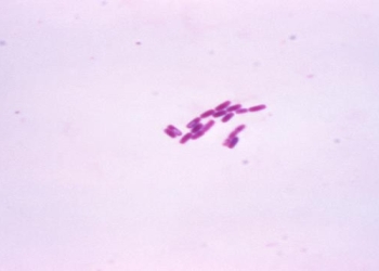 Norveç azyaşlı uşaqları əhatə edən epidemiyanı həll edir