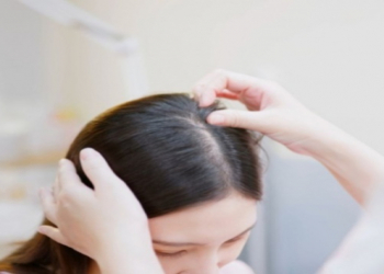 Qadınlarda saç tökülməsinin səbəbləri açıqlanıb