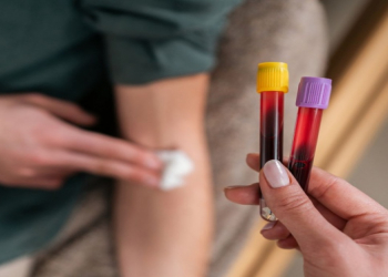 Sadə qan analizi ciddi xəstəliklərin aşkarlanmasında ilkin addım ola bilər