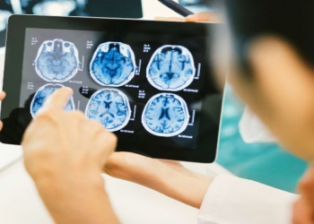 Demensiya riskini artıran qidalar açıqlanıb