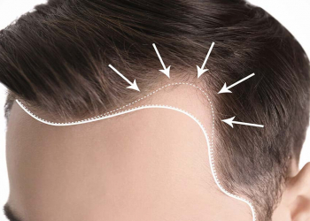 Evdə hazırlanmış yağ və yumurta maskalarının saç üçün effektivliyi