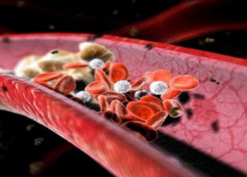 Xolesterinin azalması üçün düzgün arıqlama ürək sağlamlığını gücləndirir