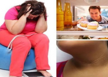 İnsulin dirənci nədir?