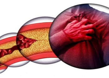 Xolesterol nədir və yüksək xolesterolun əlamətləri hansılardır?